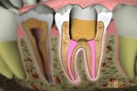 Dental Care of Ephrata image 5